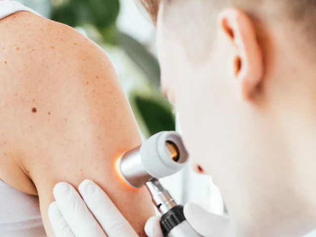 Маласезійний фолікуліт