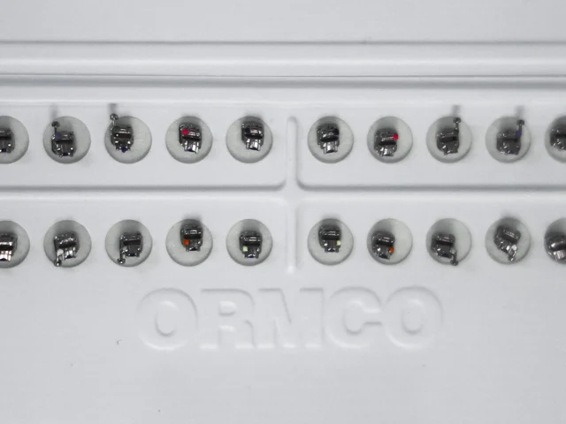 Брекети. Чи боляче ставити, носити та знімати?