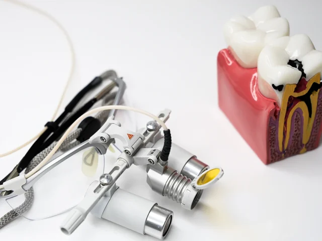 Сучасний підхід до пломбування кореневих каналів