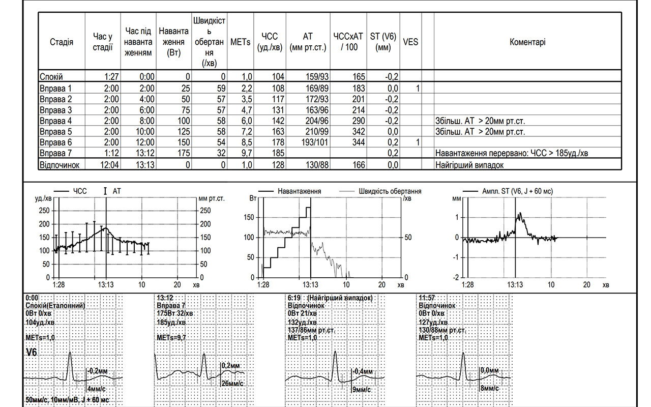 Велоергометрія