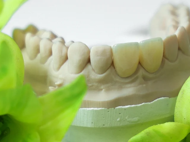 Цирконієва чи керамічна коронка — яку краще обрати?