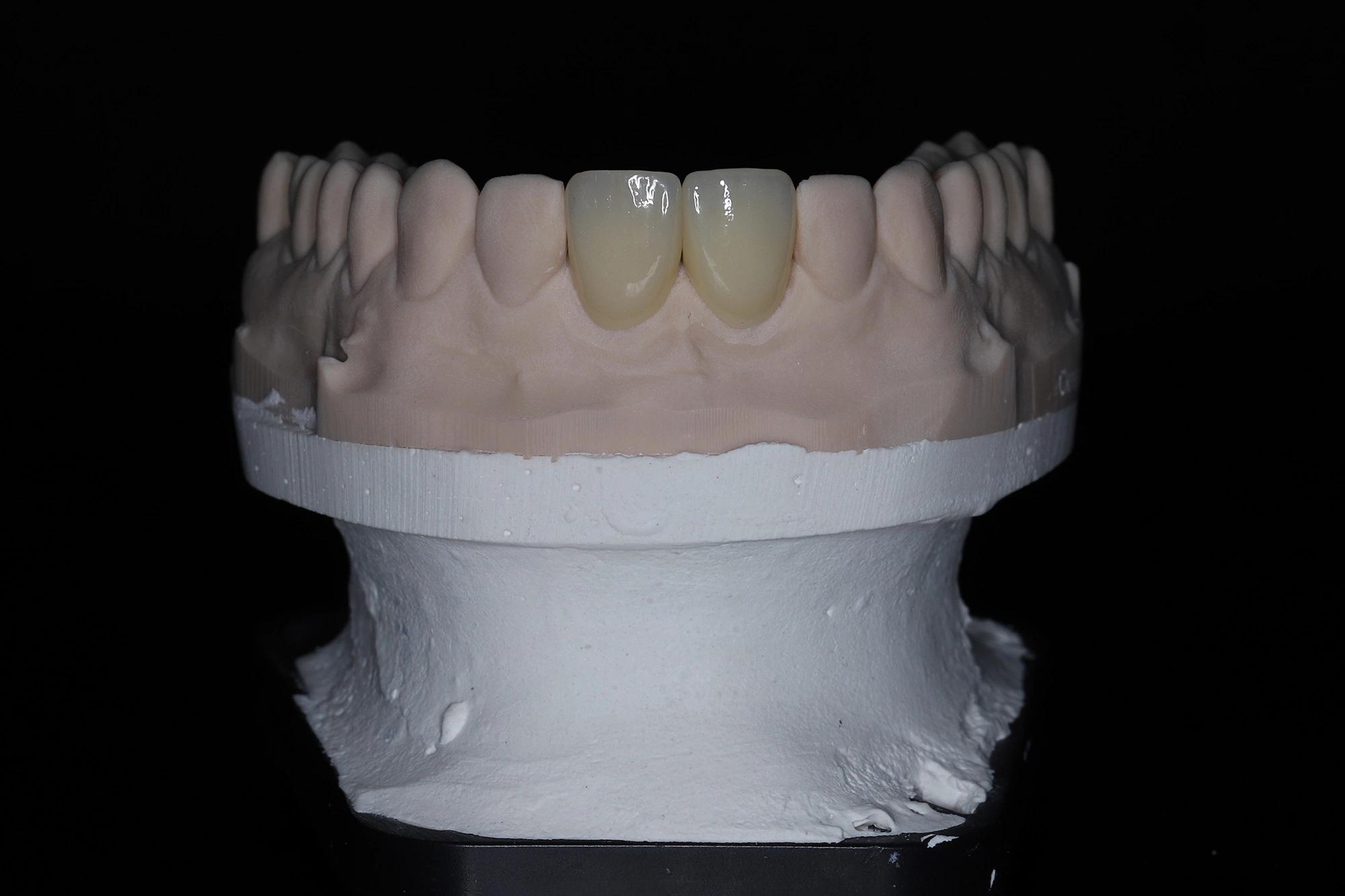 восстановление