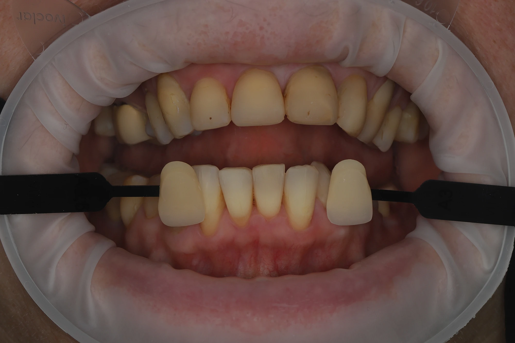 Ортопедический этап