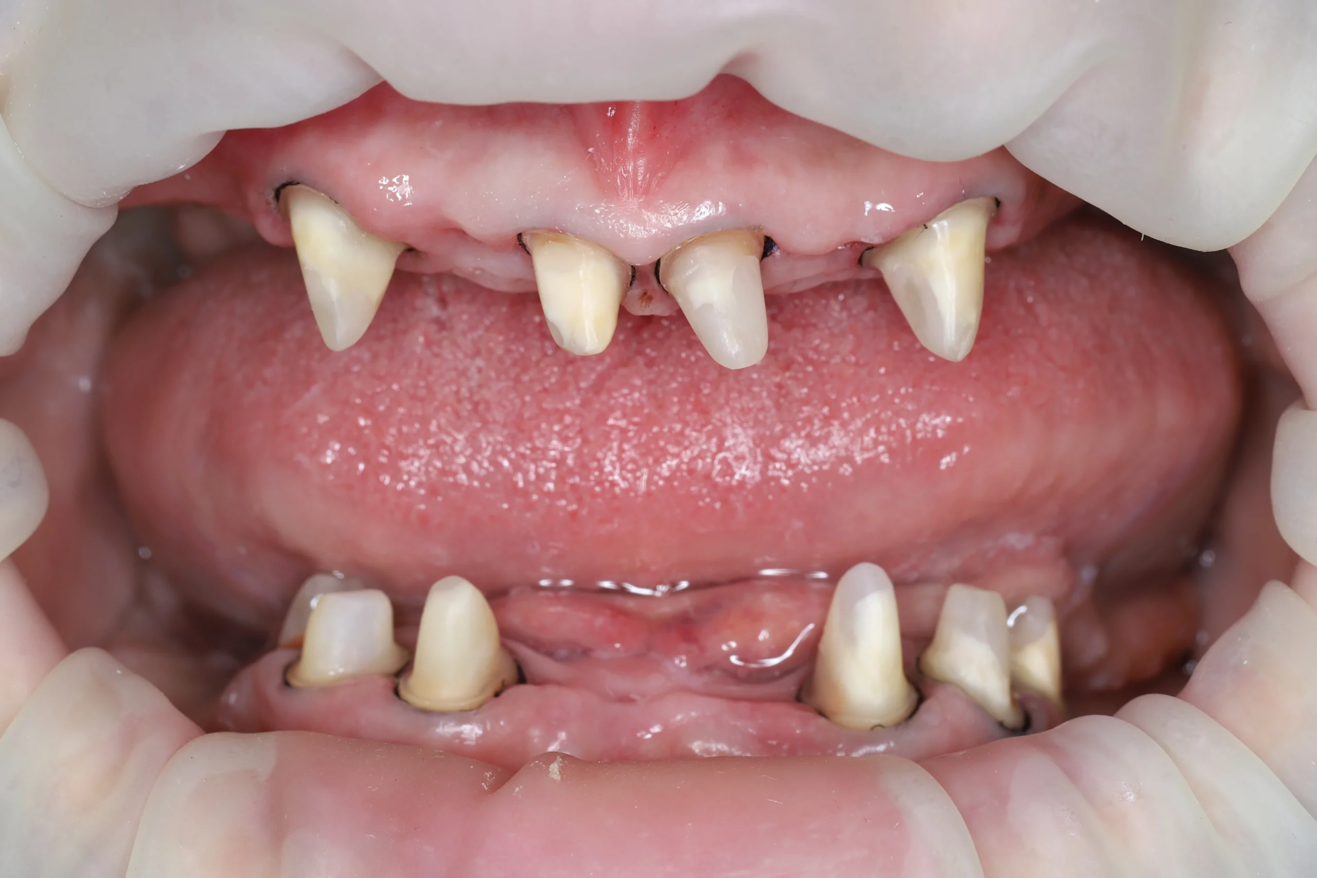 Ортопедическая подготовка зубов