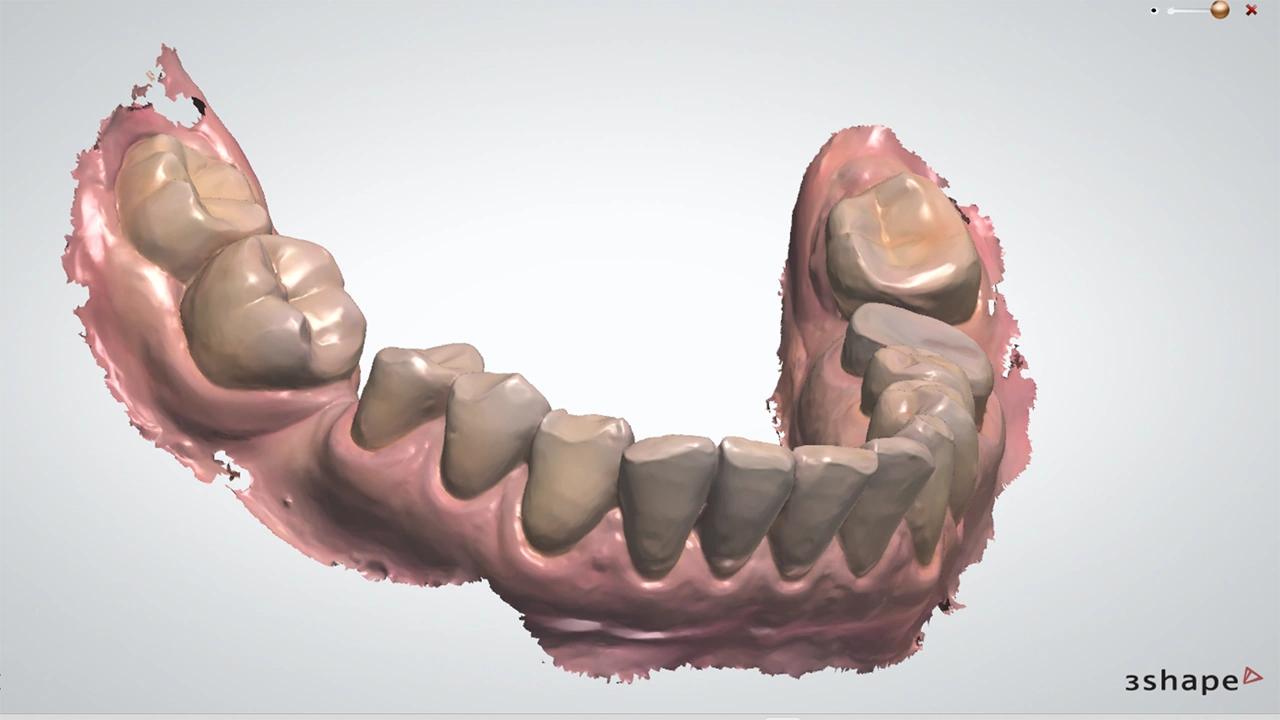 Цифровая стоматология 3d technology