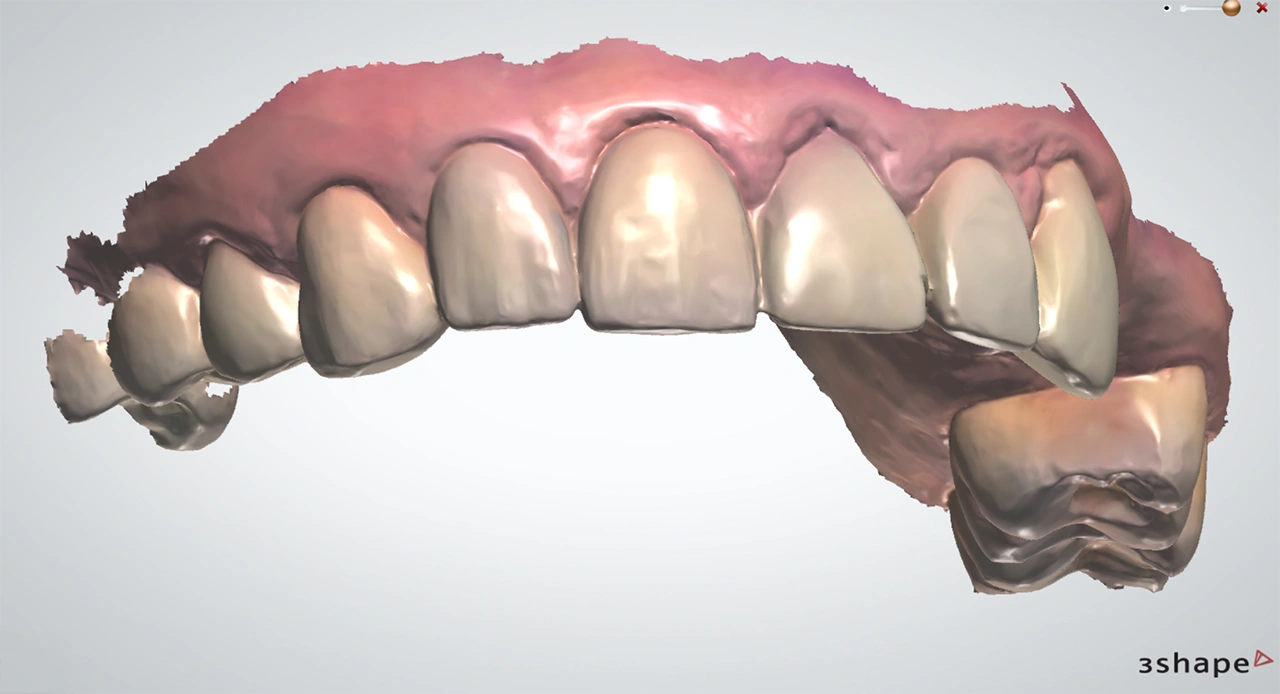 Цифровая стоматология: прецизионность и удобство