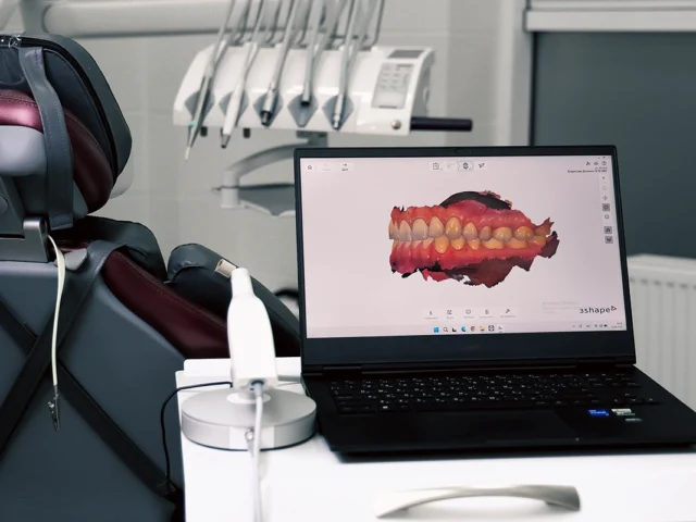 Цифровая стоматология: как 3D-технологии меняют лечение зубов